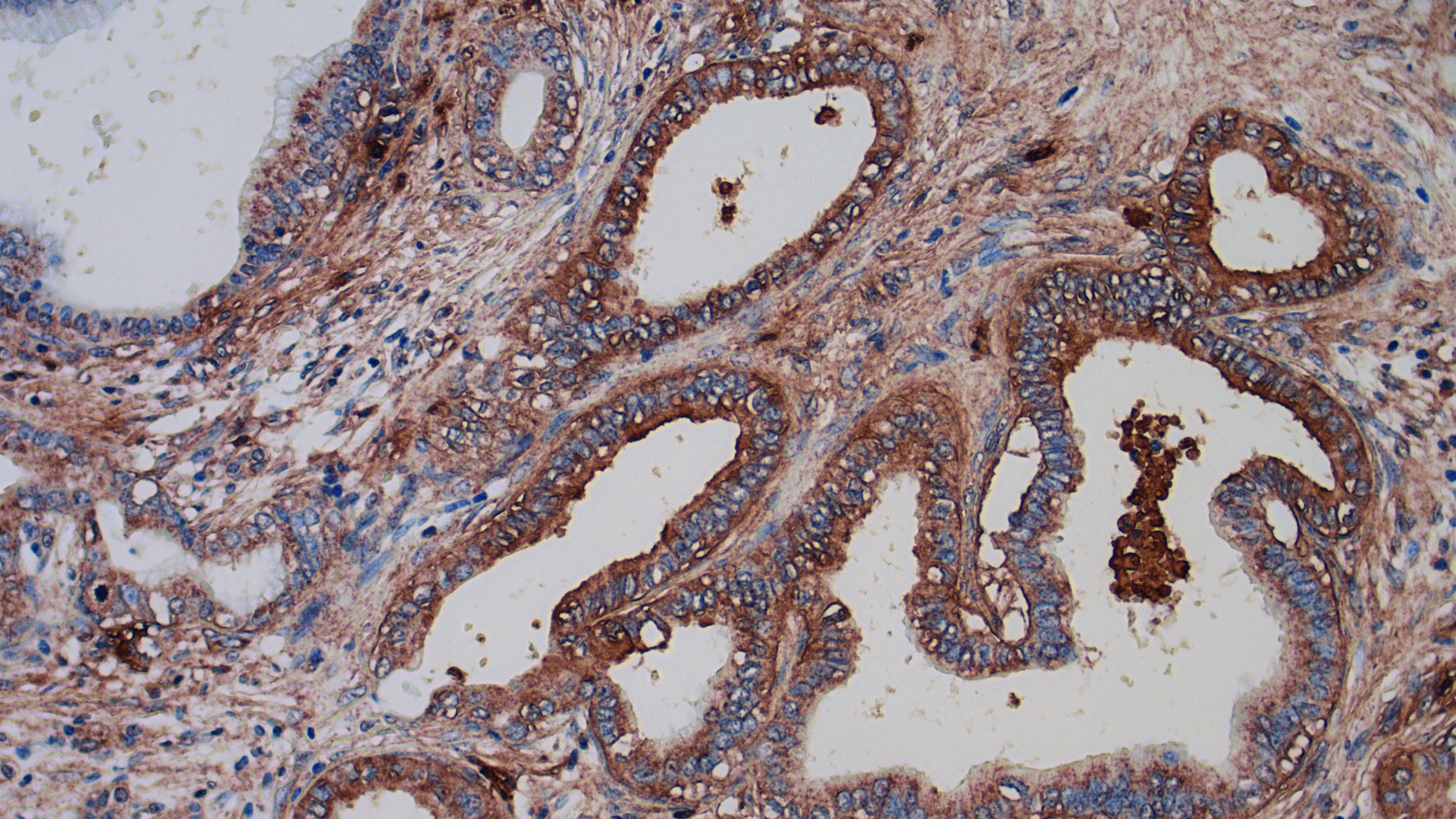 SRI is working on a new precision immunotherapy to help fight cancer