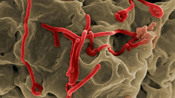 SRI researchers use AI to study deadly viruses